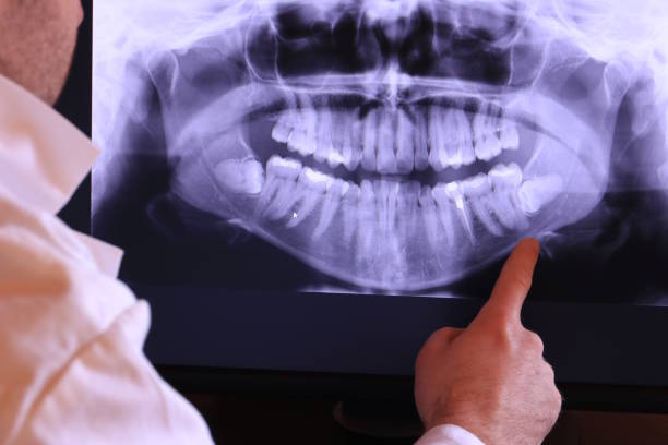 Best Emergency Tooth Extraction in New Lisbon, WI